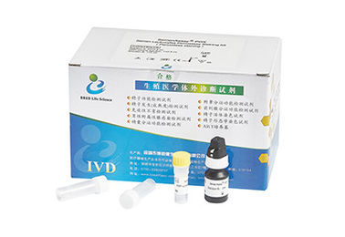 Easy Handle Peroxidase Assay Kit / Semen Leukocytes Test Kit CE Approved
